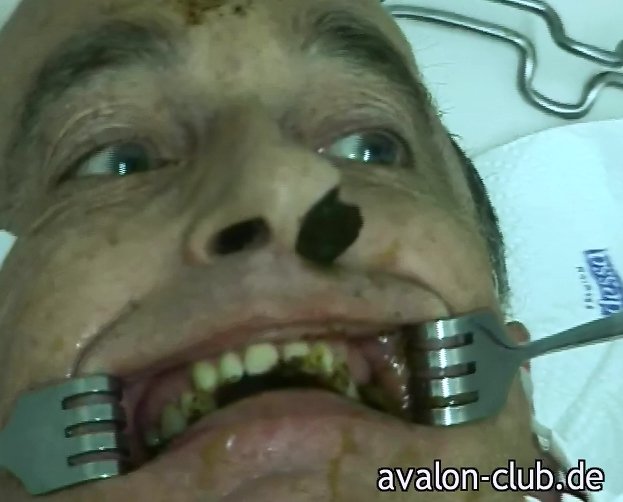 The Dentist - Teil 2 (mit Lady Kate - avalon-club.de) Screen 9